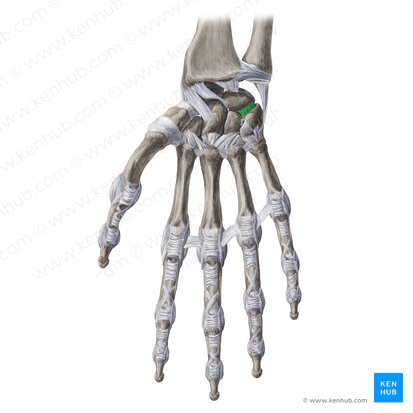 Ligamentum lunotriquetrum palmare (Hohlhandseitiges Mondbein-Dreiecksbein-Band); Bild: Yousun Koh