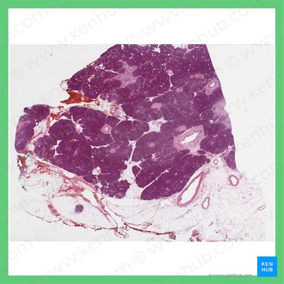 Corpo do pâncreas (Corpus pancreatis); Imagem: 