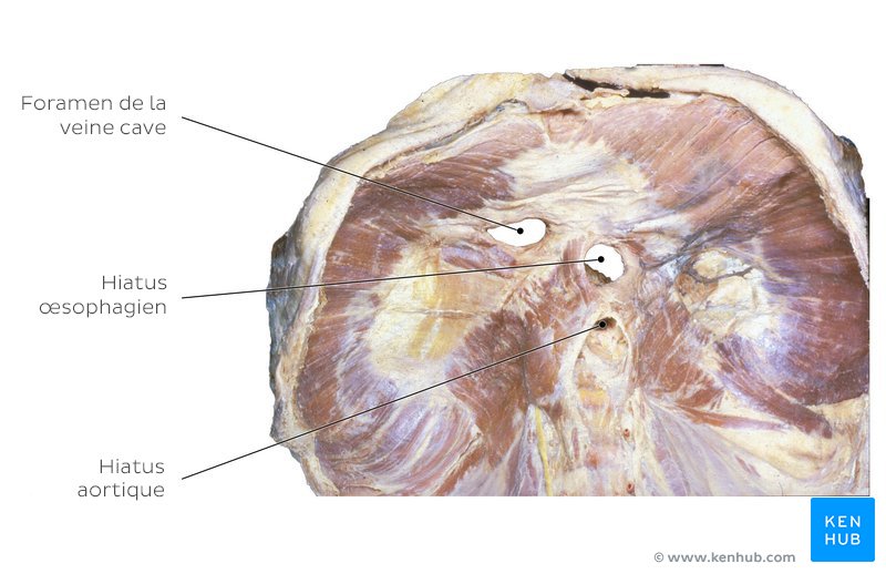 Face abdominale du diaphragme chez un cadavre : Le hiatus œsophagien passe par le pilier droit du diaphragme. Le foramen de la veine cave inférieure traverse le centre tendineux, tandis que le hiatus aortique passe derrière le diaphragme.