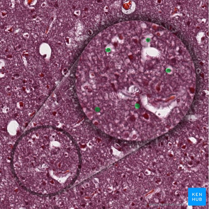 Neuroglia (Gliazellen); Bild: 