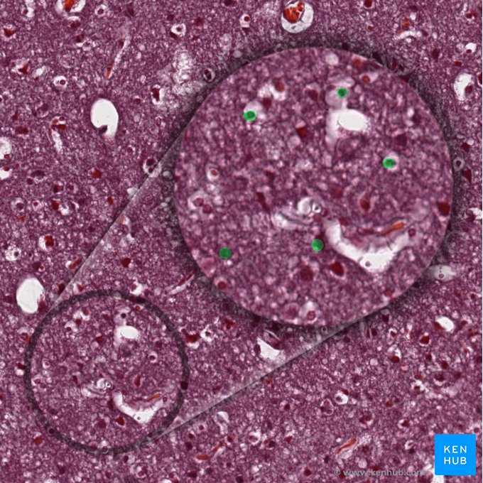 Células gliales (Neuroglia); Imagen: 