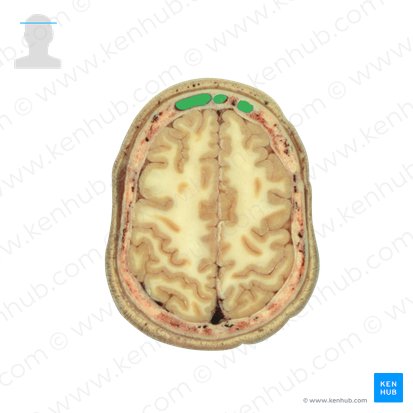 Frontal sinus (Sinus frontalis); Image: National Library of Medicine