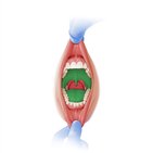 Cavidade oral