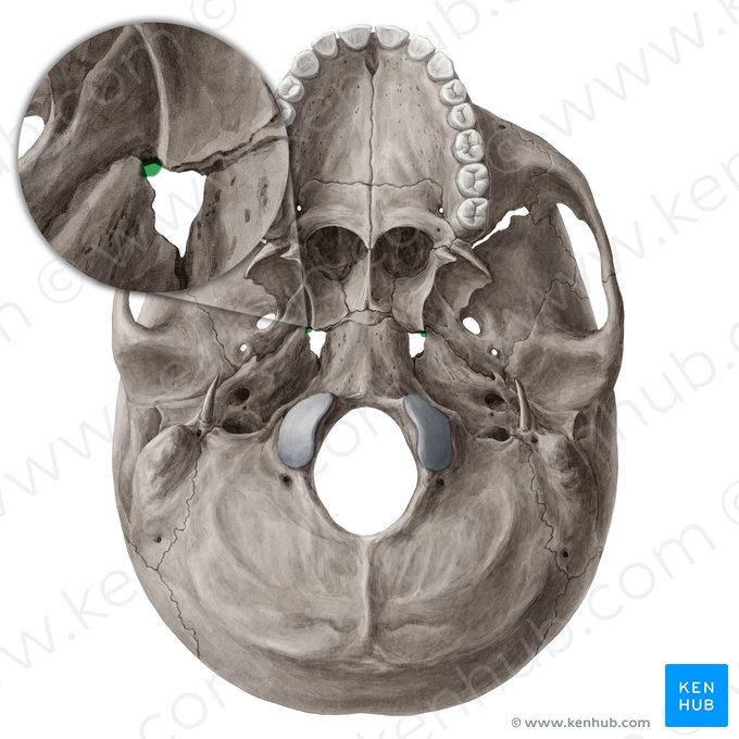 Conducto pterigoideo del hueso esfenoides (Canalis pterygoideus); Imagen: Yousun Koh