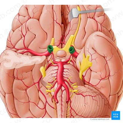 Internal carotid artery (Arteria carotis interna); Image: Paul Kim