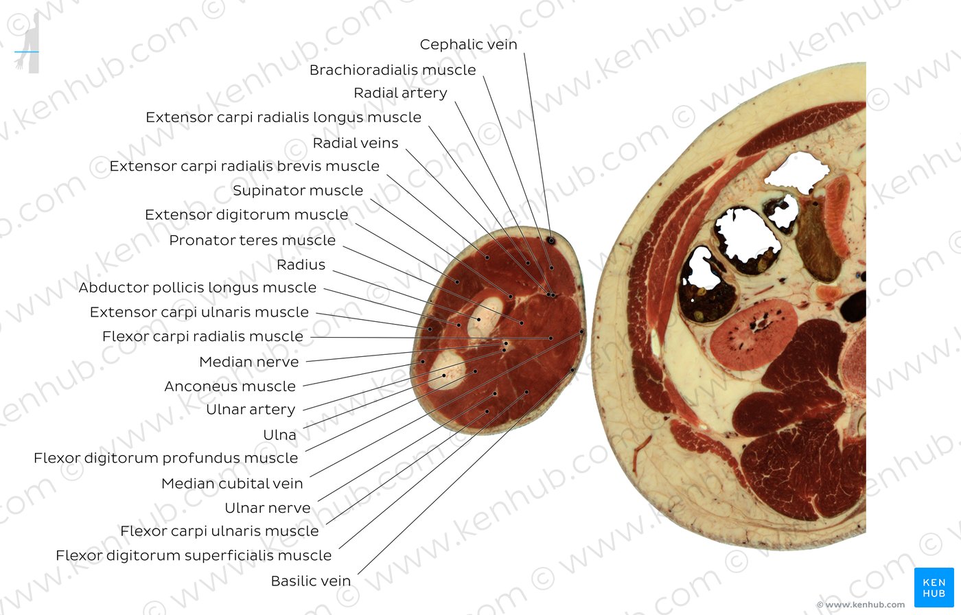Supinator muscle level: Overview