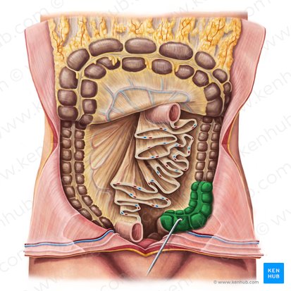 Cólon sigmoide (Colon sigmoideum); Imagem: Irina Münstermann