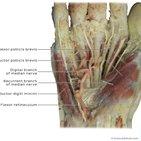 Clinical case:  Glomus tumor of the hand misdiagnosed as carpal tunnel syndrome