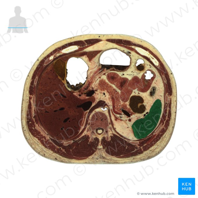 Spleen (Splen); Image: National Library of Medicine