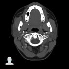 Radiological anatomy