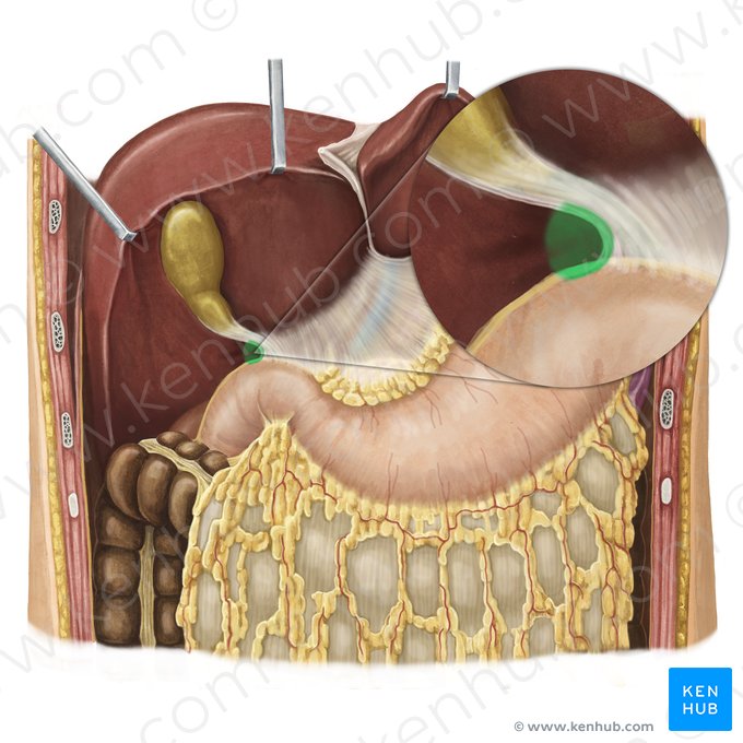 Foramen omental (Foramen omentale); Imagen: Irina Münstermann