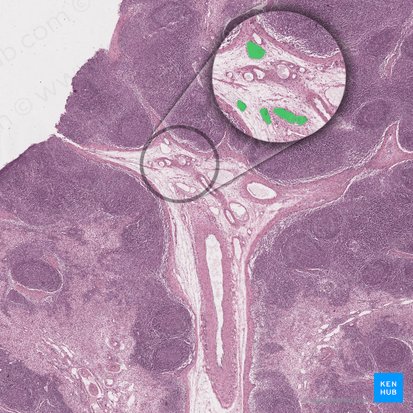 Vaso linfático eferente (Vas lymphaticum efferens); Imagen: 