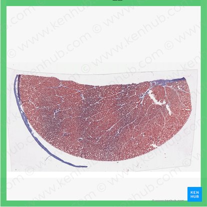 Testículo (Testis); Imagen: 