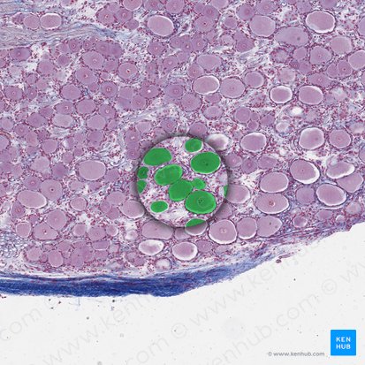 Neurônio pseudounipolar (Neuron pseudounipolare); Imagem: 