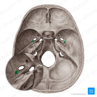 Foramen espinoso del hueso esfenoides (Foramen spinosum); Imagen: Yousun Koh