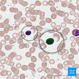 Small lymphocyte (Lymphocytus parvus); Image: 