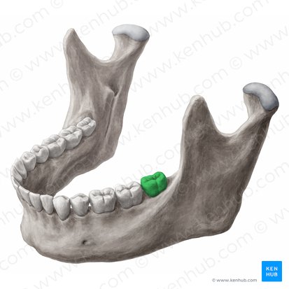 Dens molaris tertius sinister mandibularis (Linker unterer dritter Molar); Bild: 