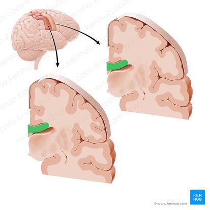 Corpus callosum; Image: Paul Kim