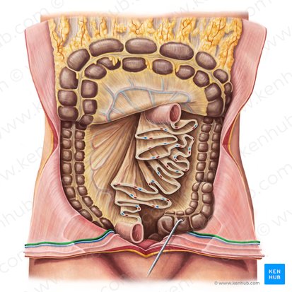Inferior epigastric artery (Arteria epigastrica inferior); Image: Irina Münstermann