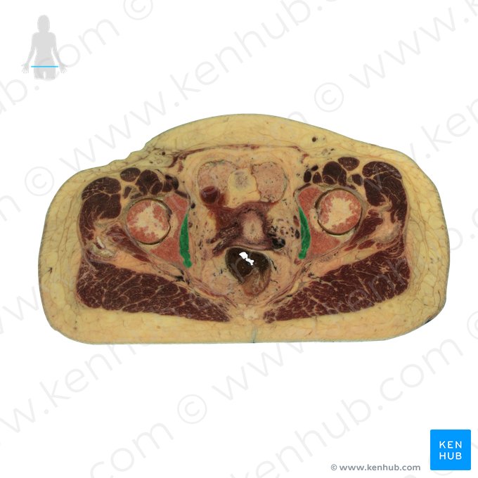 Musculus obturatorius internus (Innerer Hüftlochmuskel); Bild: National Library of Medicine