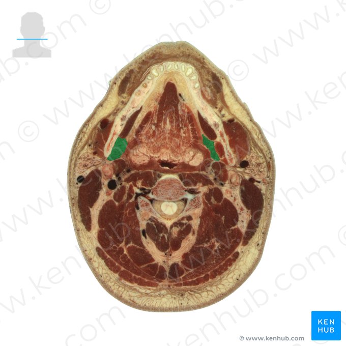 Glândula submandibular (Glandula submandibularis); Imagem: National Library of Medicine