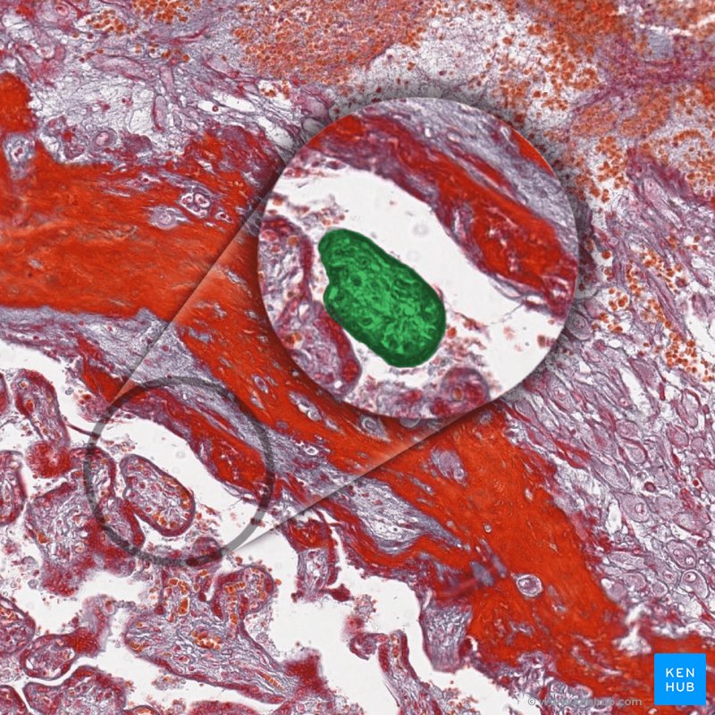 Chorionic villi - histological slide