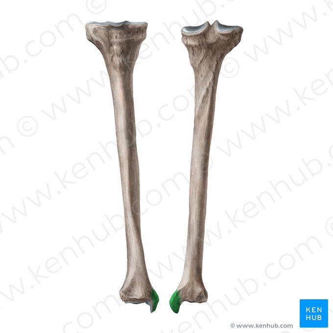 Maleolo medial de la tibia (Malleolus medialis tibiae); Imagen: Irina Münstermann