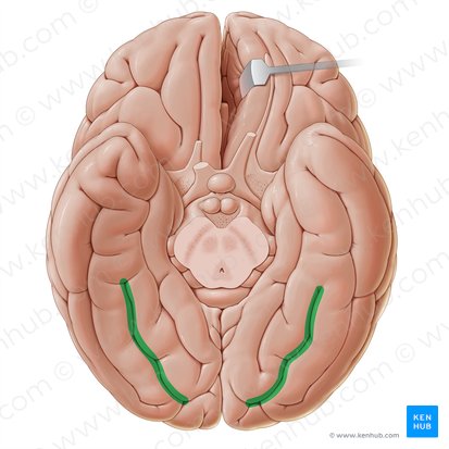 Surco fusiforme medio (Sulcus sagittalis gyri fusiformis); Imagen: Paul Kim