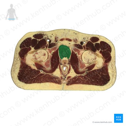 Urinary bladder (Vesica urinaria); Image: National Library of Medicine