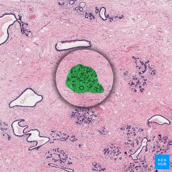 Terminal duct lobular unit (Lobulus mammae); Image: 