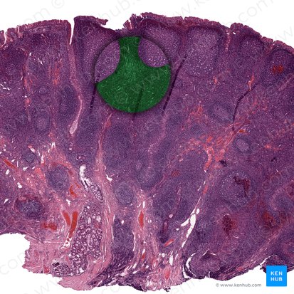 Paracortex; Image : 