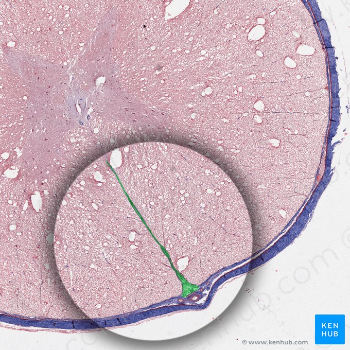 Fissura mediana anterior da medula espinal (Fissura mediana anterior medullae spinalis); Imagem: 