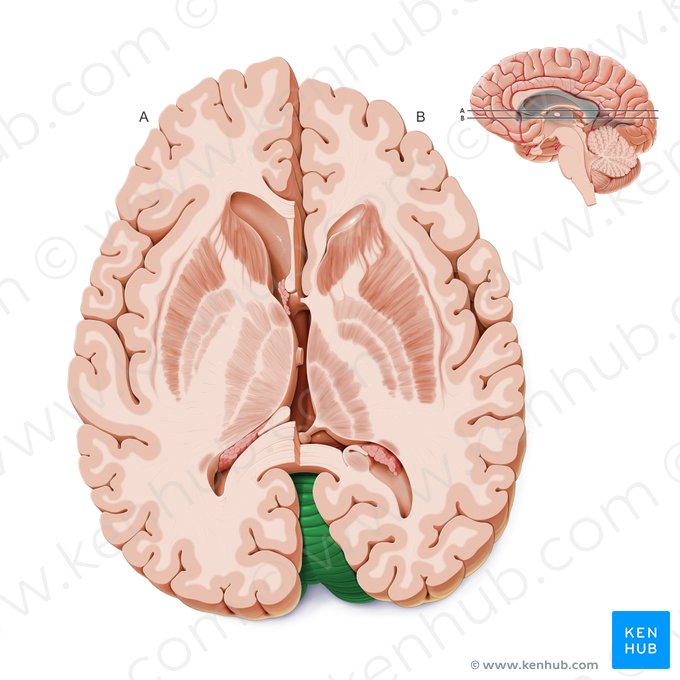 Cerebelo (Cerebellum); Imagen: Paul Kim