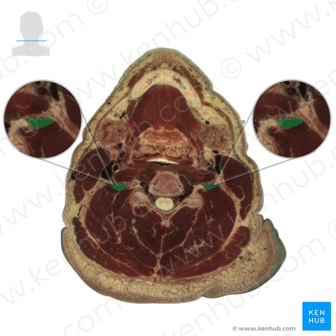 Musculus scalenus medius (Mittlerer Treppenmuskel); Bild: National Library of Medicine