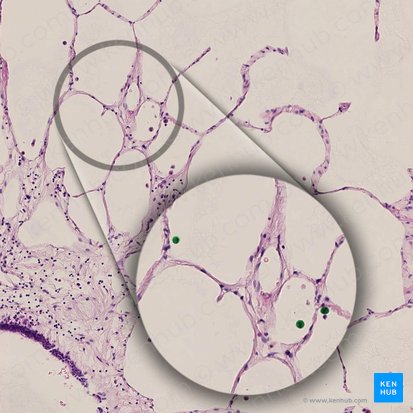 Macrophagocytus alveolaris (Alveolarmakrophage); Bild: 