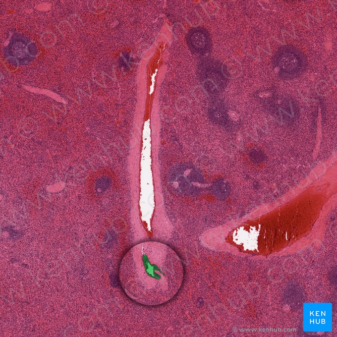 Artéria trabecular do baço (Arteria trabecularis splenis); Imagem: 