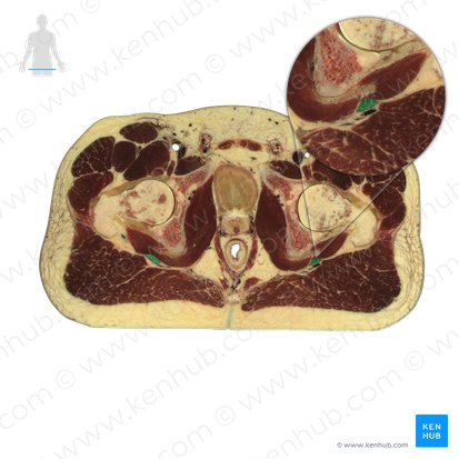 Nervus ischiadicus (Sitzbeinnerv); Bild: National Library of Medicine