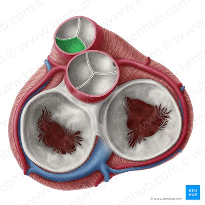 Cúspide semilunar esquerda da valva pulmonar (Valvula semilunaris sinistra valvae trunci pulmonalis); Imagem: Yousun Koh