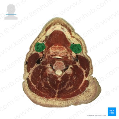Glândula submandibular (Glandula submandibularis); Imagem: National Library of Medicine