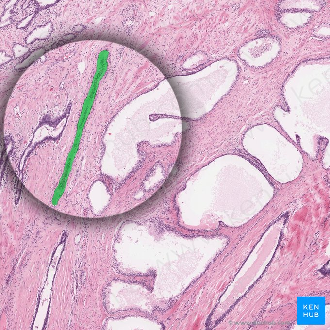 Coronal venous plexus (Plexus venosus coronalis); Image: 