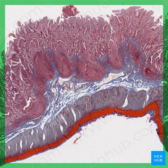 Ileum; Image: 