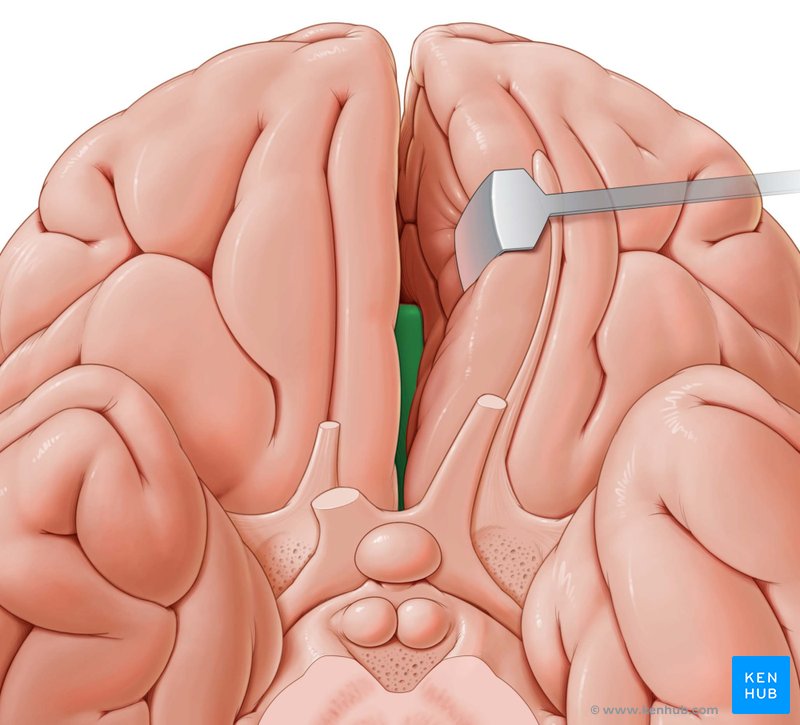 Genu of the corpus callossum - Inferior view