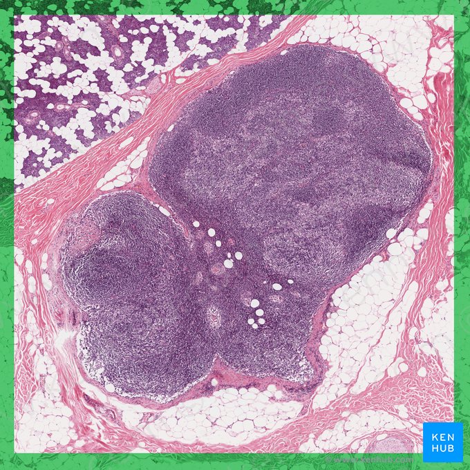 Ganglio linfático normal (Nodus lymphoideus nonreactivus); Imagen: 