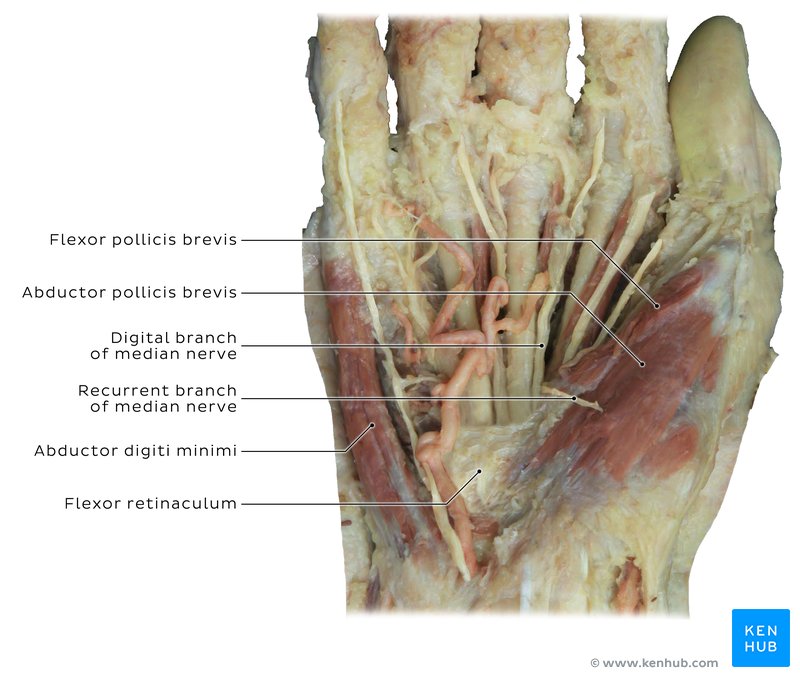Flexor retinaculum and carpal tunnel - cadaveric section
