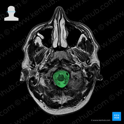 Foramen magno del hueso occipital (Foramen magnum); Imagen: 