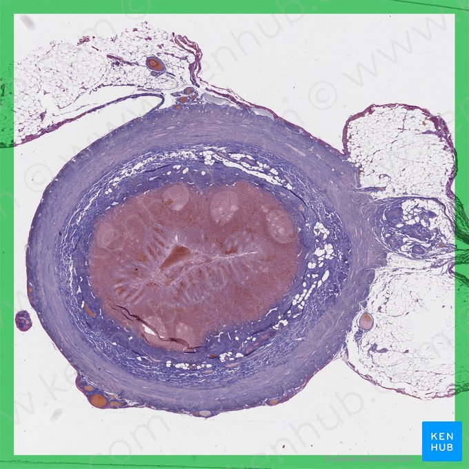 Apéndice vermiforme (Appendix vermiformis); Imagen: 