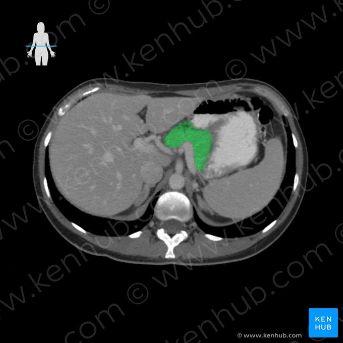 Corpo do pâncreas (Corpus pancreatis); Imagem: 