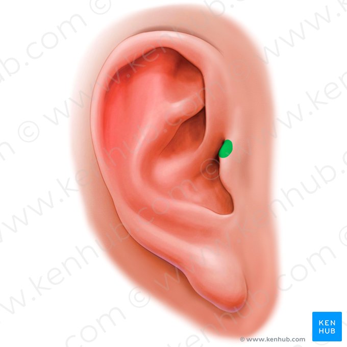 Supratragic tubercle of auricle (Tuberculum supratragicum auriculae); Image: Paul Kim