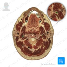 Vena jugularis interna (Innere Drosselvene); Bild: National Library of Medicine