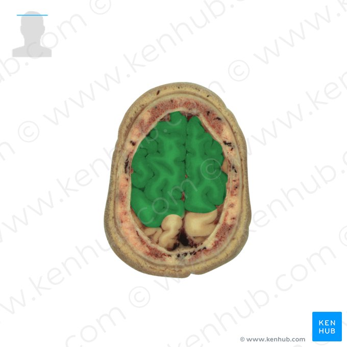 Lobo frontal (Lobus frontalis); Imagem: National Library of Medicine